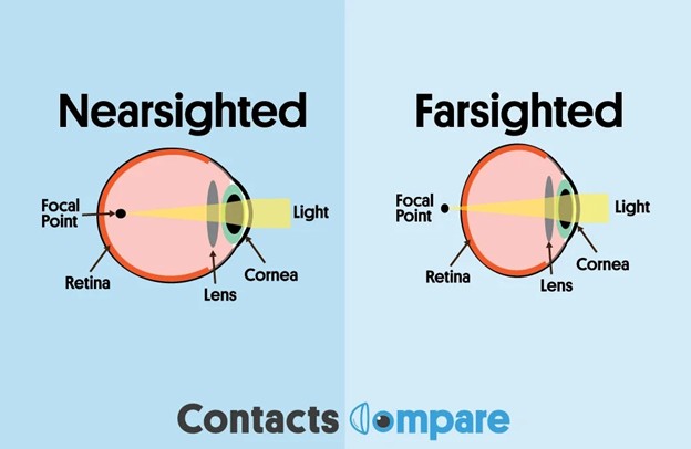 Nearsightedness vs Farsightedness Comparison
